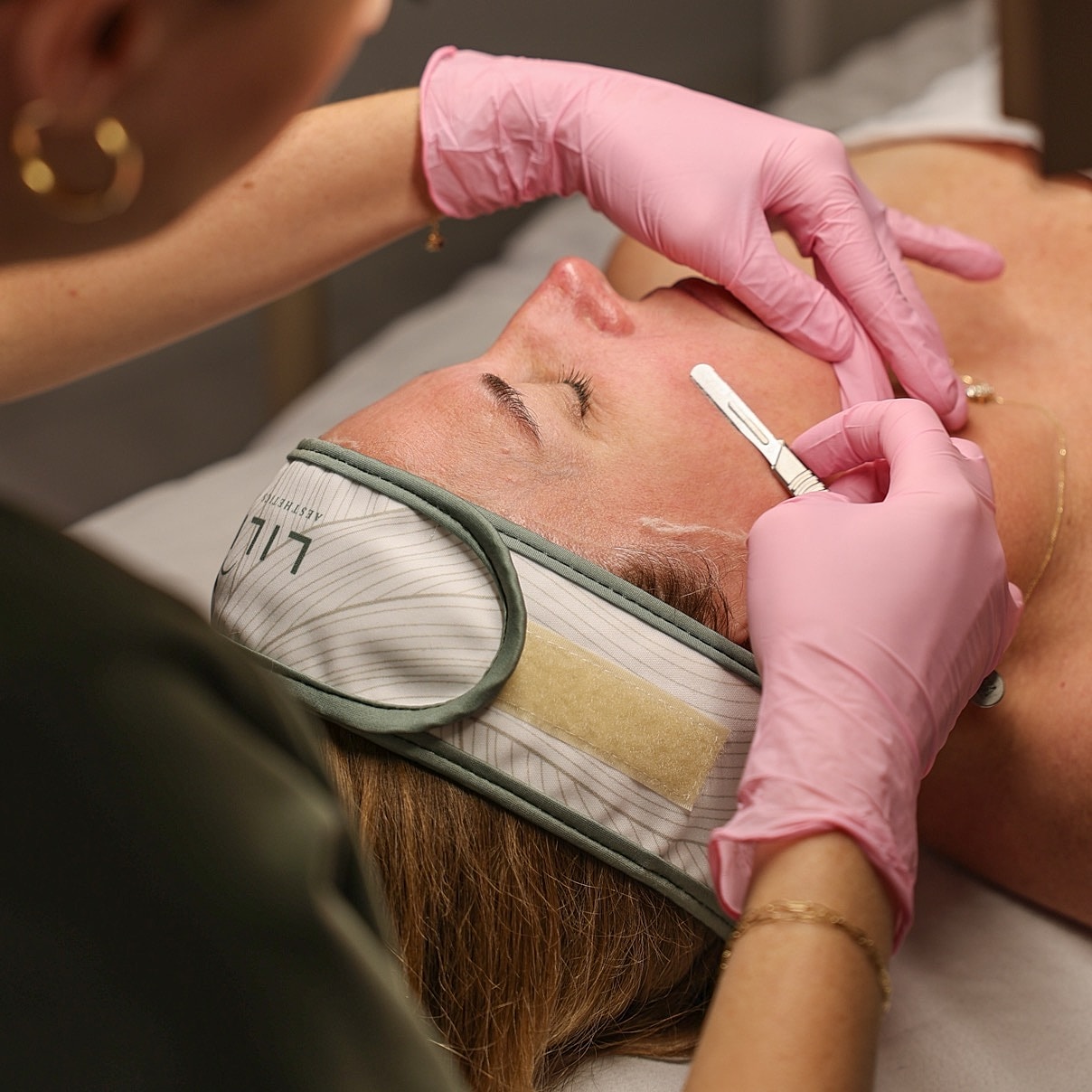 Facial treatment with dermaplaning technique.
